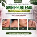 Advanced Skin Treatments For Healthy, Radiant Skin In Suncity