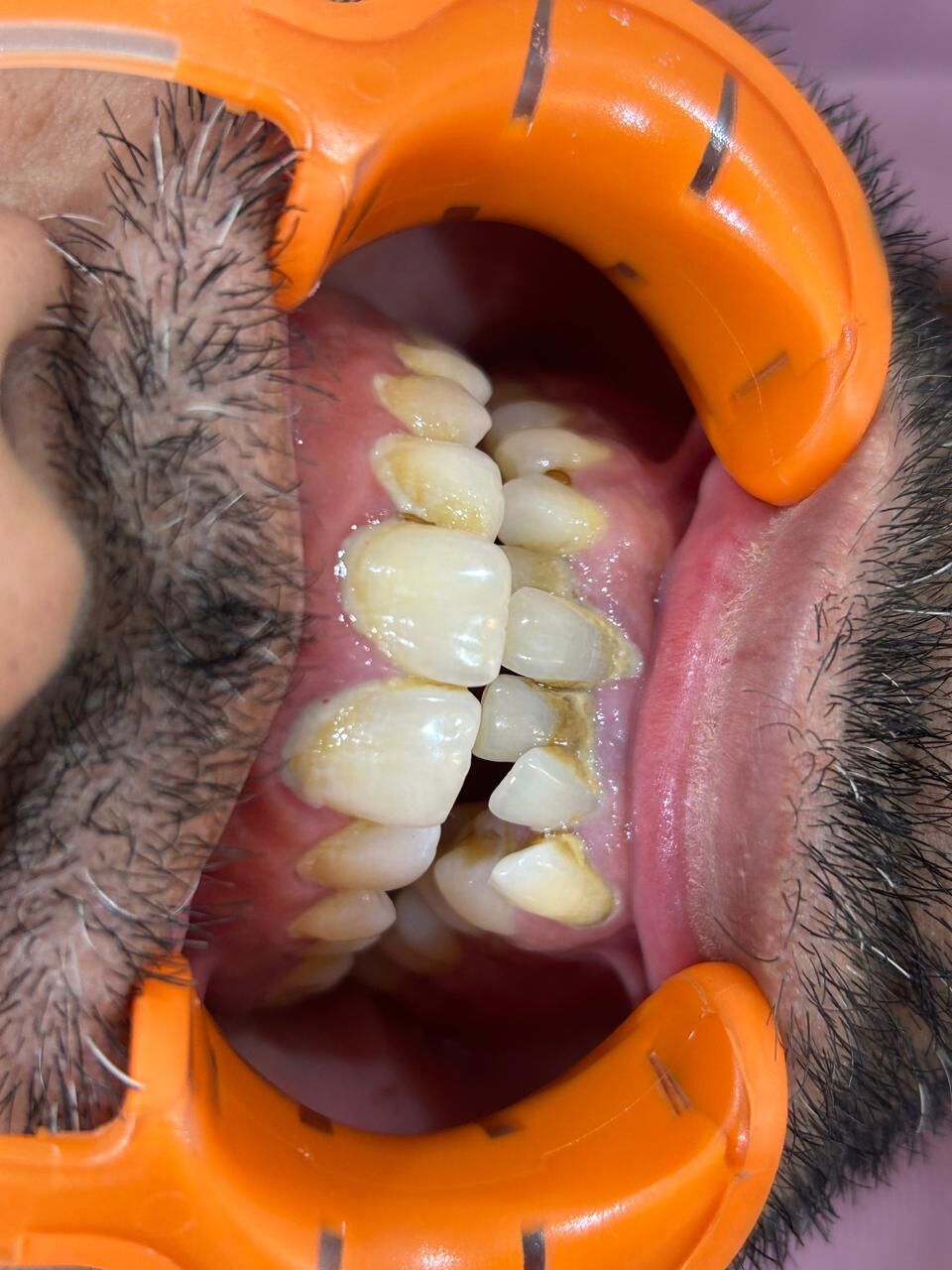 Pune, Dental, Epitome Dental Care