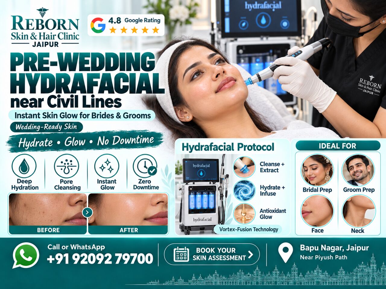 Jaipur, Health & Beauty Items, INR 2499,  Pre-Wedding Hydrafacial Treatment Near Civil Lines Jaipur For Brides