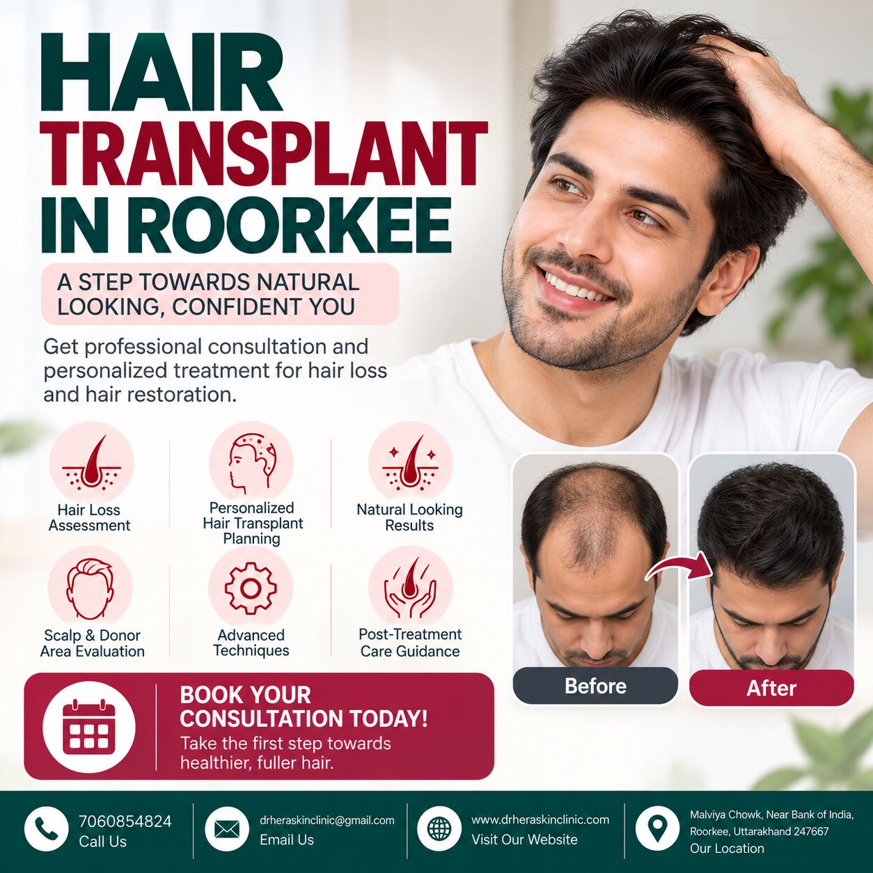 Mumbai, Medical, Hair Transplant In Roorkee For Natural-Looking Hair Restoration
