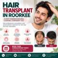 Hair Transplant In Roorkee For Natural-Looking Hair Restoration