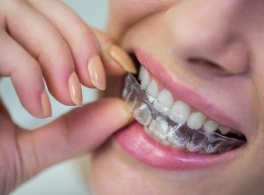 Mumbai, Health, Invisalign In Borivali: How Clear Aligners Work