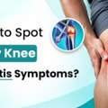 Knee Osteoarthritis Affecting Your Movement? Know The Early Signs | Dr. Divyesh Bukalsaria