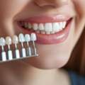 Trusted Bleeding Gums Care & Dental Check Up Somerset For Healthier Smiles