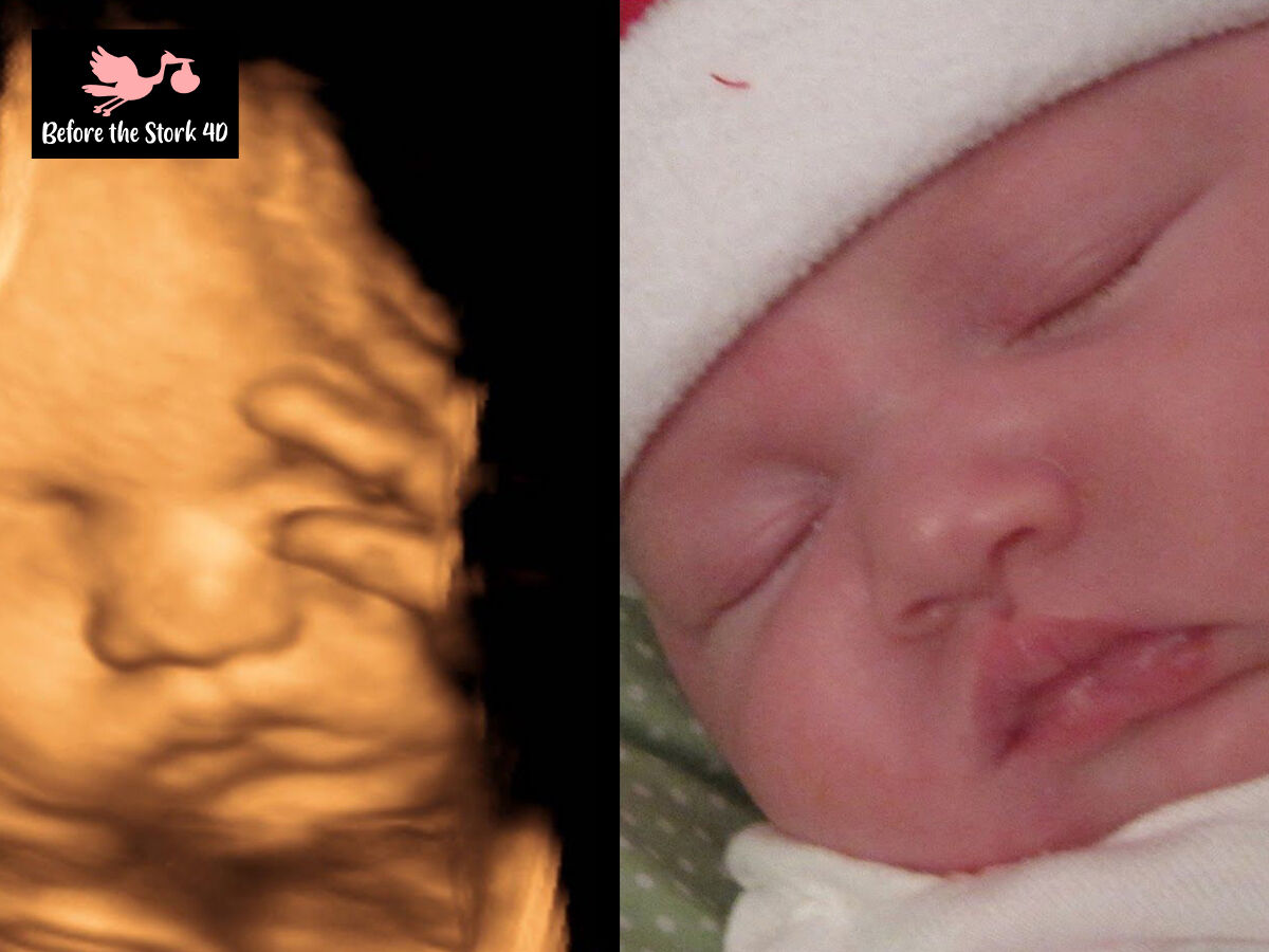 Los Angeles, Health, See Your Baby Clearly With 3D Ultrasound & 3D Ultrasound Near Me