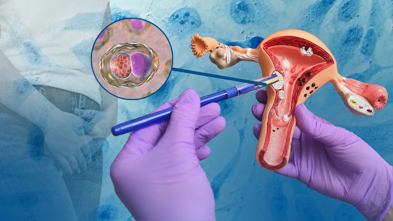 Ghaziabad, Health, Modern Cervical Cancer Treatment In Noida By Dr. Manish Singhal