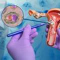 Modern Cervical Cancer Treatment In Noida By Dr. Manish Singhal