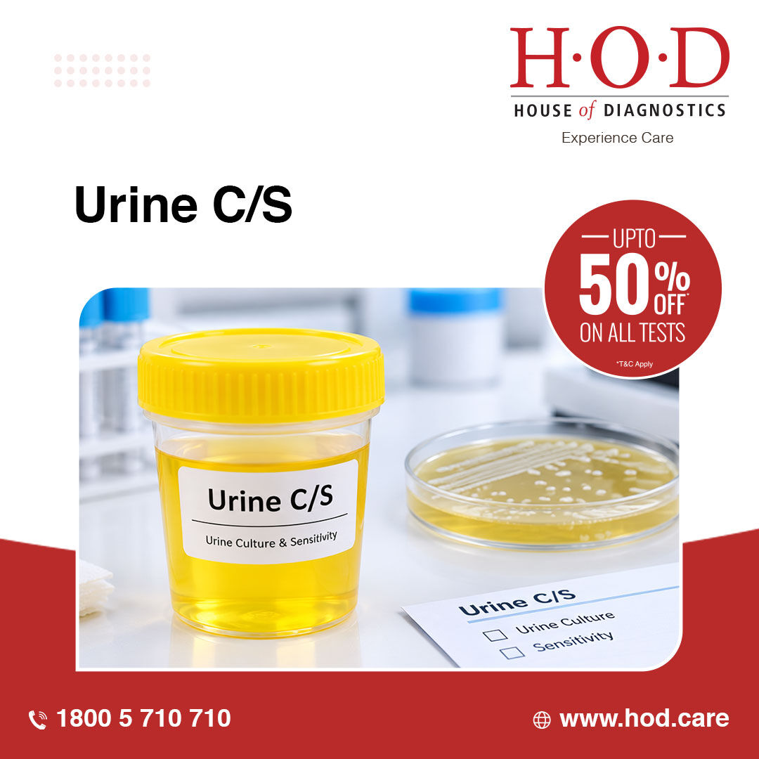 New Delhi, Health & Beauty Items, INR 499,  Urine Culture Test For Identifying Bacteria Causing Urinary Infections