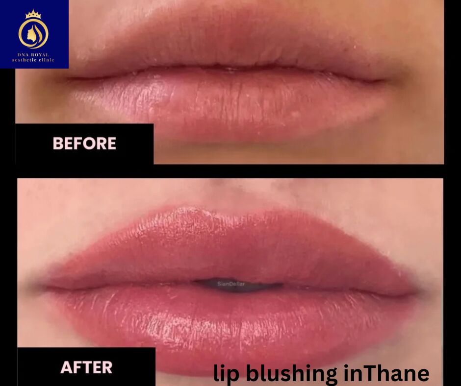 Thane, Fashion & Design, Transform Your Lips With Lip Blushing In Thane | DNA Royal.
