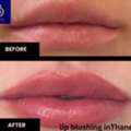 Transform Your Lips With Lip Blushing In Thane | DNA Royal.