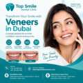 Veneer Dubai &ndash; Dental Veneers At Top Smile Dental Clinic