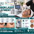 Carbon Laser Treatment In Jaipur For Skin Rejuvenation