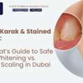 AFFORD Clinic - Al Nahda Dubai - The Expat&rsquo;s Guide To Safe Teeth Whitening Vs. Routine