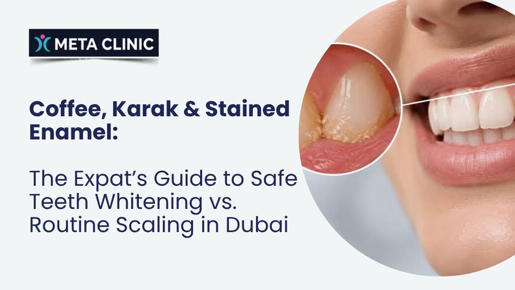 Al Barsha, Dental, Teeth Whitening Vs. Routine Scaling In Dubai - META Clinic In Dubai - Dental Clinic Dubai