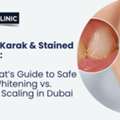 Teeth Whitening Vs. Routine Scaling In Dubai - META Clinic In Dubai - Dental Clinic Dubai