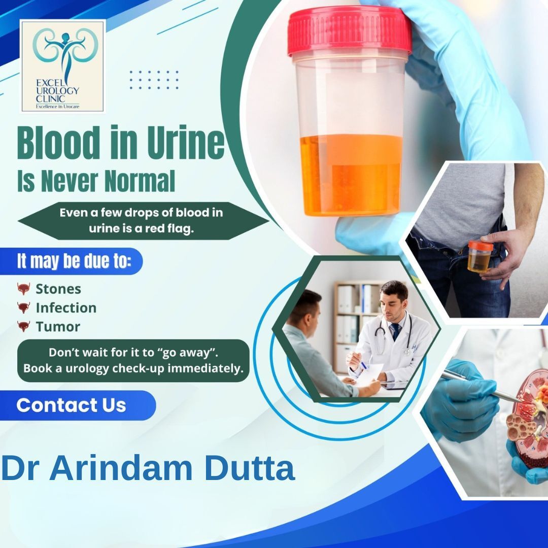 Kolkata, Health, Best Urologist In Kolkata | Dr. Arindam Dutta, Ballygunge