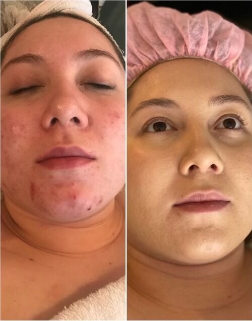 New York, Beautician, Refresh Your Skin With Professional Facial Care