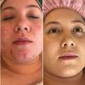 Refresh Your Skin With Professional Facial Care