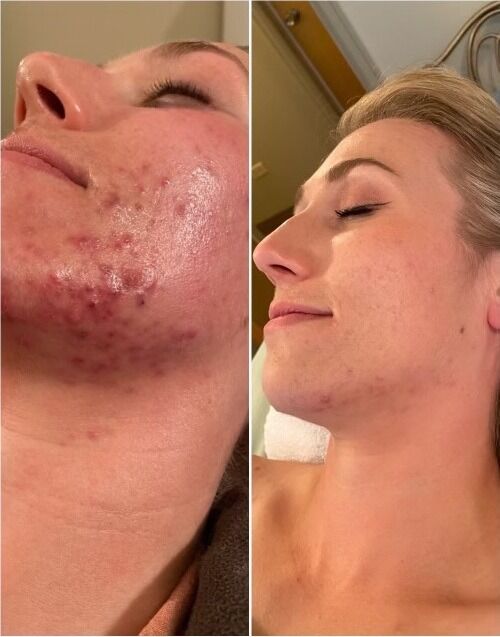 New York, Beautician, Refresh Your Skin With Professional Facial Care