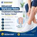 Advanced Varicose Veins Treatment In Rajasthan For Better Relief