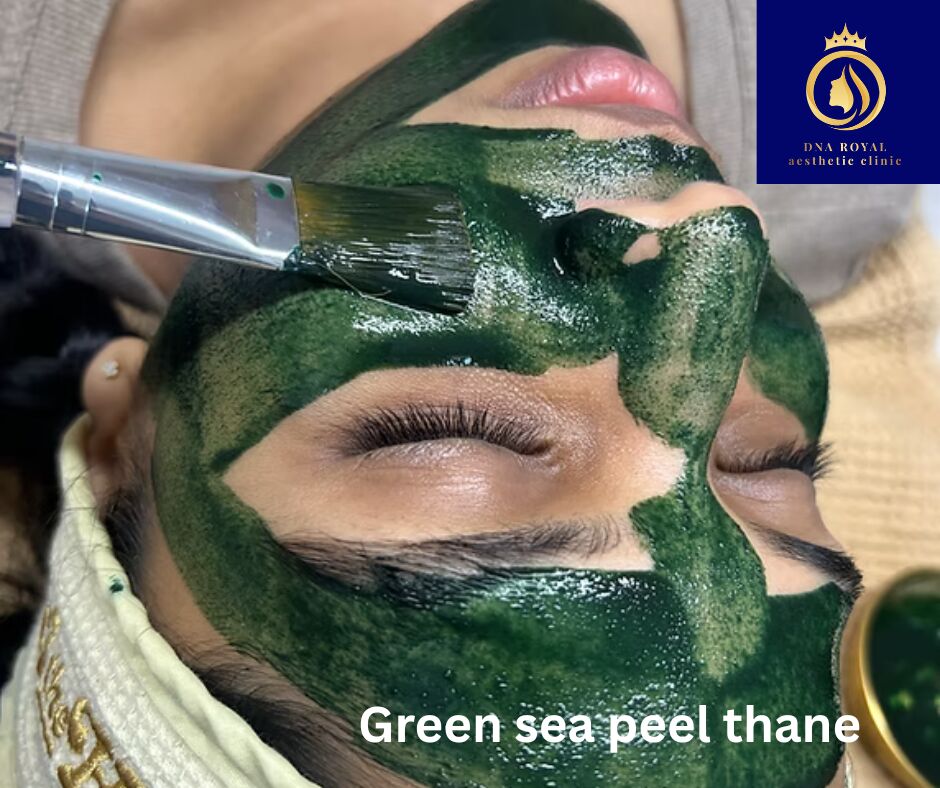 Thane, Fashion & Design, Green Sea Peel: Advanced Skin Peeling Treatment By DNA Royal.