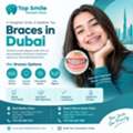 Braces In Dubai – Explore Orthodontic Treatment At Top Smile Dental Clinic