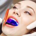 Professional Smile Brightening And Stain Removal Teeth Whitening In Seattle