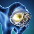 Bone Cancer Specialist In Noida &ndash; Dr. Manish Singhal