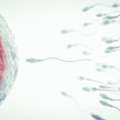IUI Treatment Cost In Delhi - Dr Rhythm Gupta
