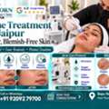 INR 2499,  Acne Treatment In Jaipur For Cystic Pimples
