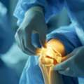 Need Help With Knee Pain Or Joint Problems?