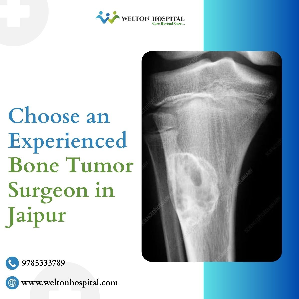 Jaipur, Health, Choose An Experienced Bone Tumor Surgeon In Jaipur