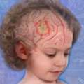 Quality Targeted Therapy Treatment In Noida | Dr. Manish Singhal