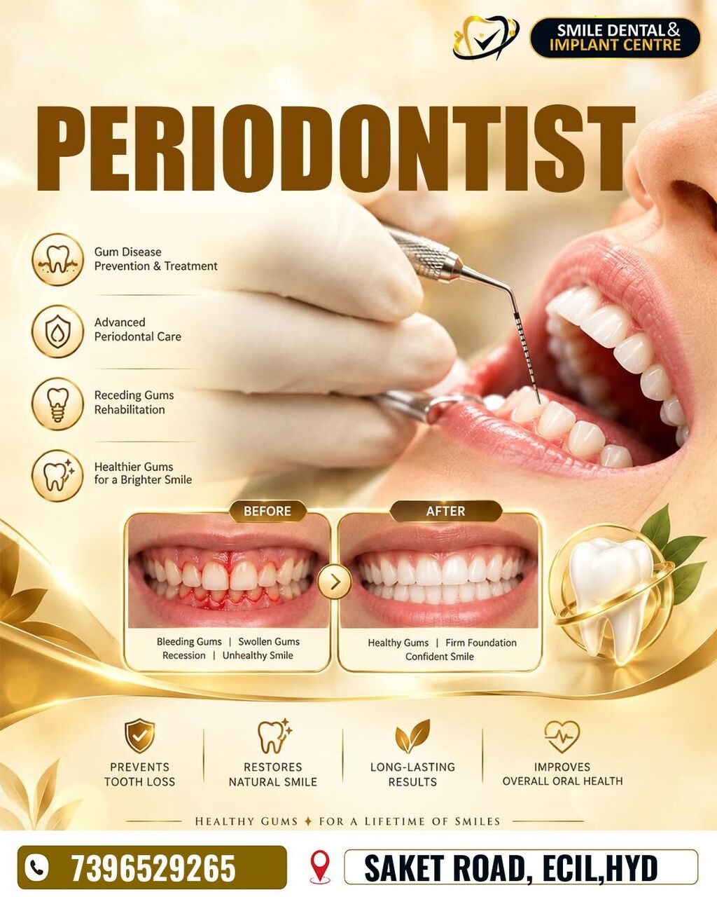 Hyderabad, Dental, Periodontist In AS Rao Nagar | Gum Disease Treatment | Smile Dental And Implant Centre