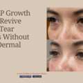 How PRP Growth Factors Revive Hollow Tear Troughs AFFORD CLlNIC