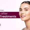 How To Maintain Results After Facial Treatments