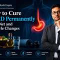 Know How To Cure GERD Permanently From Dr. Kash Gupta