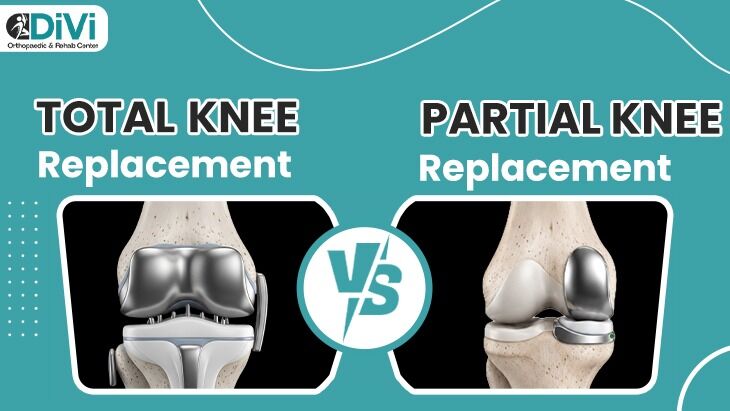 Navi Mumbai, Health, Unsure About Knee Replacement Surgery? | Dr. Divyesh Bukalsaria