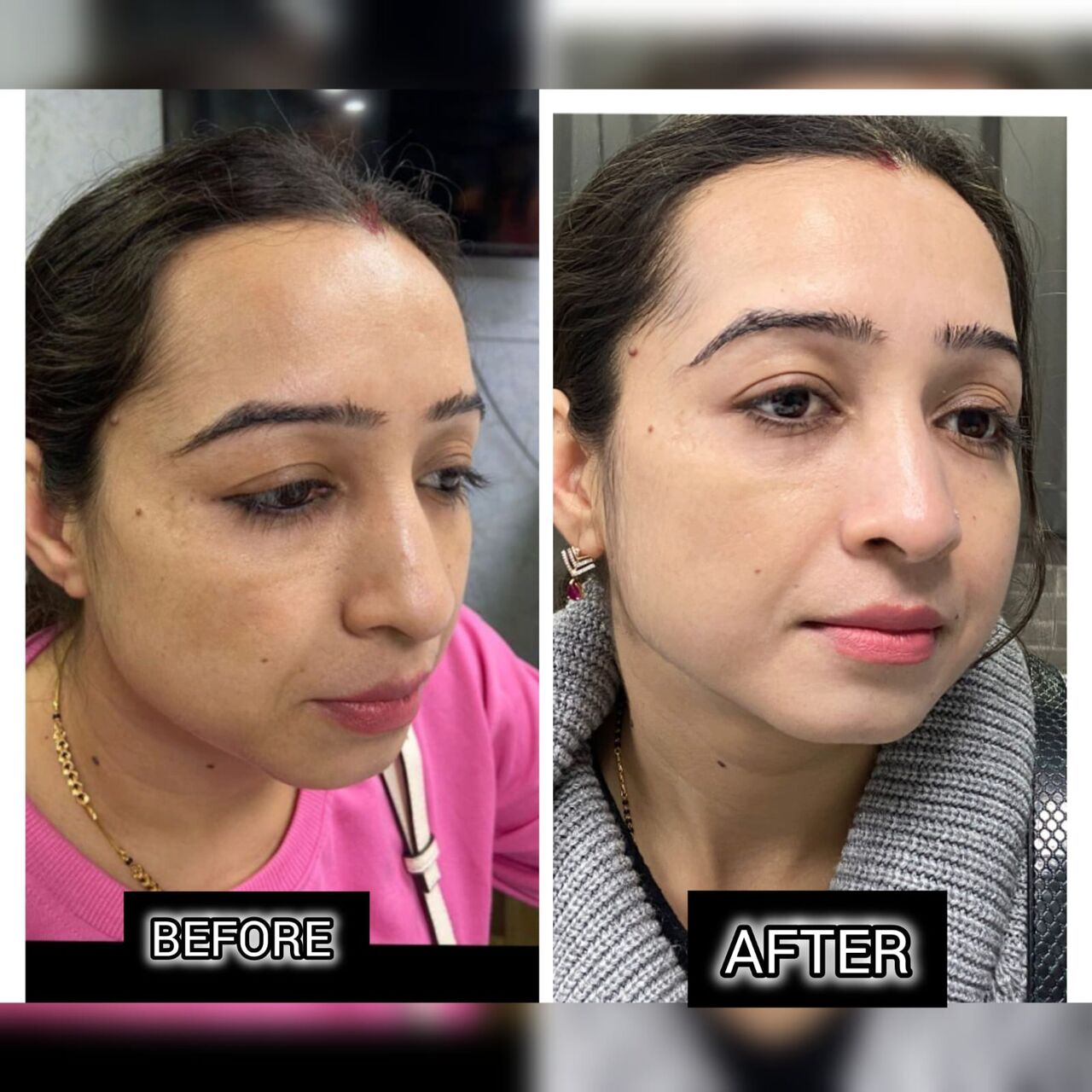 New Delhi, Health, Best Skin Specialist In Delhi