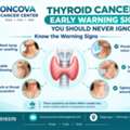Thyroid Cancer: Early Warning Signs You Should Never Ignore