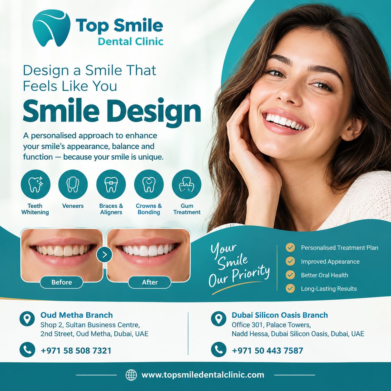 Dubai, Dental, Smile Design In Dubai &ndash; Personalised Smile Solutions At Top Smile Dental Clinic