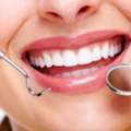 Which Dental Clinic Should I Choose For Complete Dental Care?