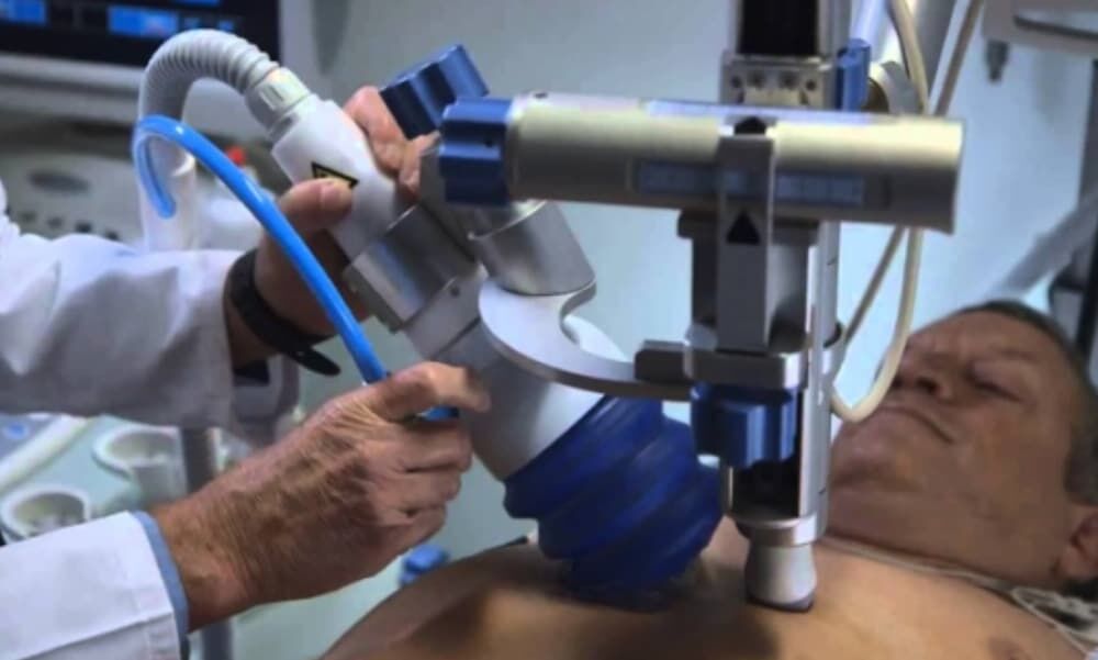 Ahmedabad, Health, Best ESMR Treatment In India At Lfystyle Wellness