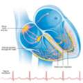 Best Premature Ventricular Contractions Treatment In UAE | TheHeart.ae
