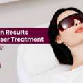 How To Maintain Results After Laser Treatment In Dubai