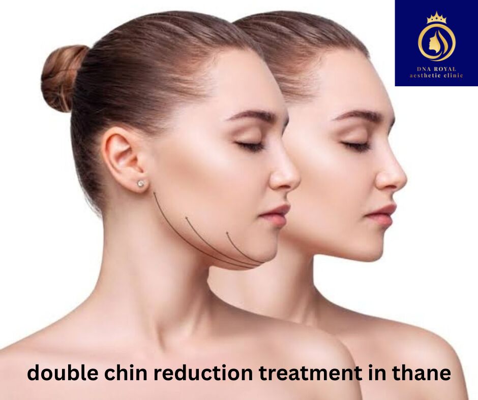 Thane, Fashion & Design, Double Chin Reduction Treatment In Thane | DNA Royal.
