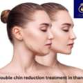 Double Chin Reduction Treatment In Thane | DNA Royal.