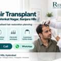 INR 29999,  Your Hairline Deserves A Personalised Plan&mdash;Hair Transplant In Banjara Hills