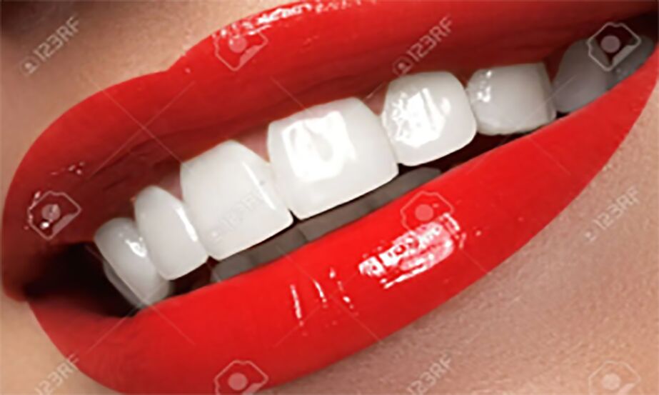 New Delhi, Dental, Dental Services In Delhi