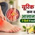 Uric Acid Kam Karne Ka Aasan Tarika: 7 Din Mein Badlein Apni Ye Aadatein